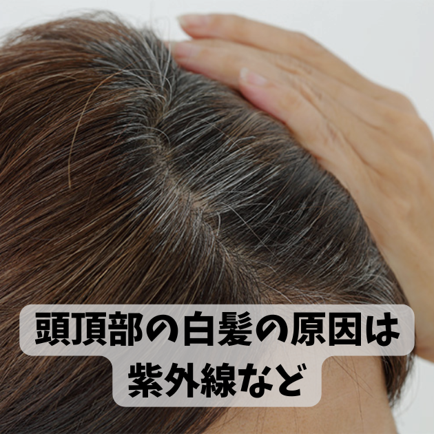 頭の左側に白髪が多いのはなぜ？