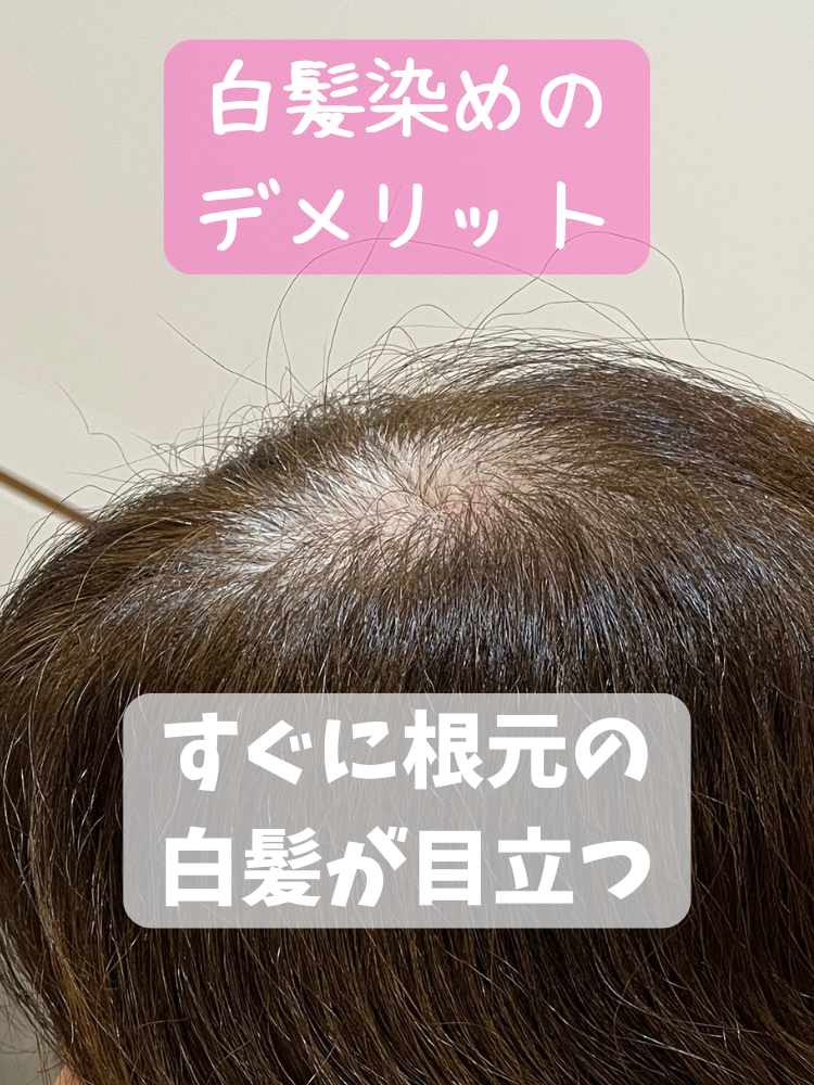 白髪ぼかし 1年続けると