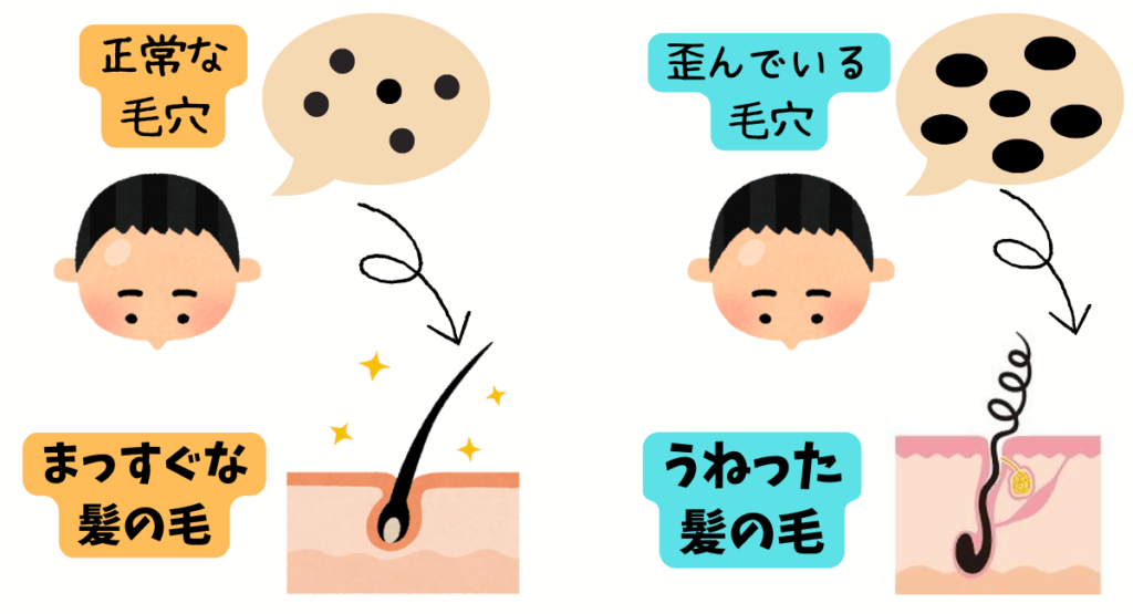 髪のうねりとパサつき